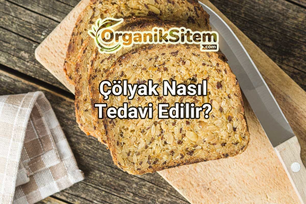 Çölyak Nasıl Tedavi Edilir?