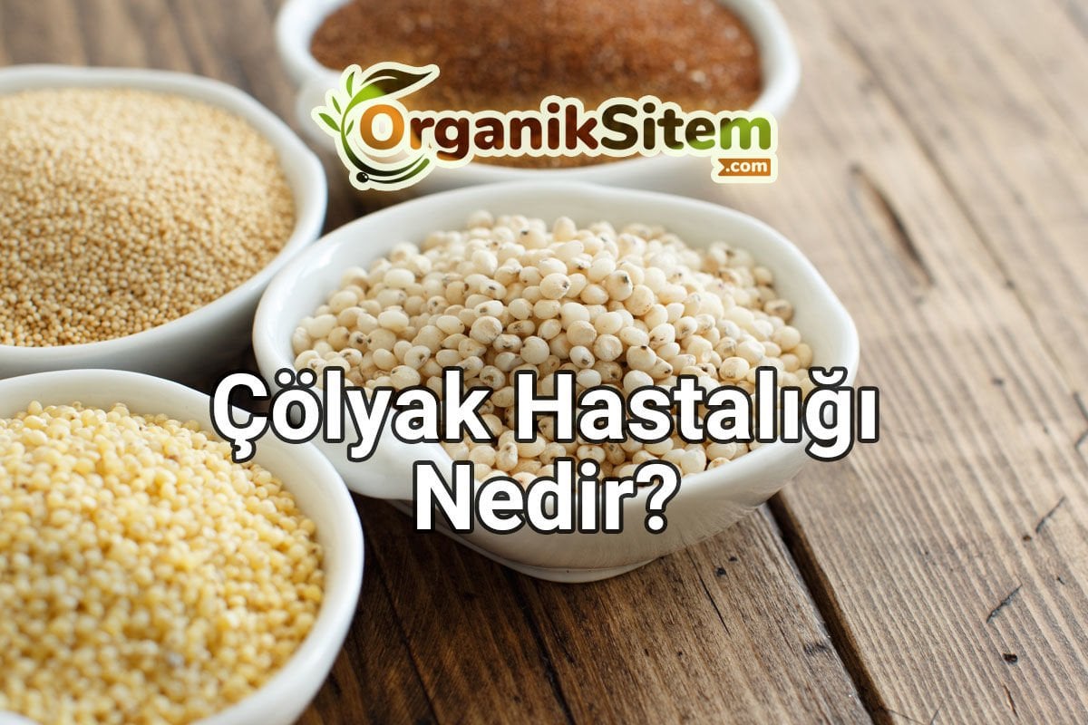 Çölyak Hastalığı Nedir?