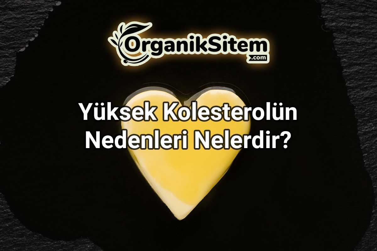 Yüksek Kolesterolün Nedenleri Nelerdir?