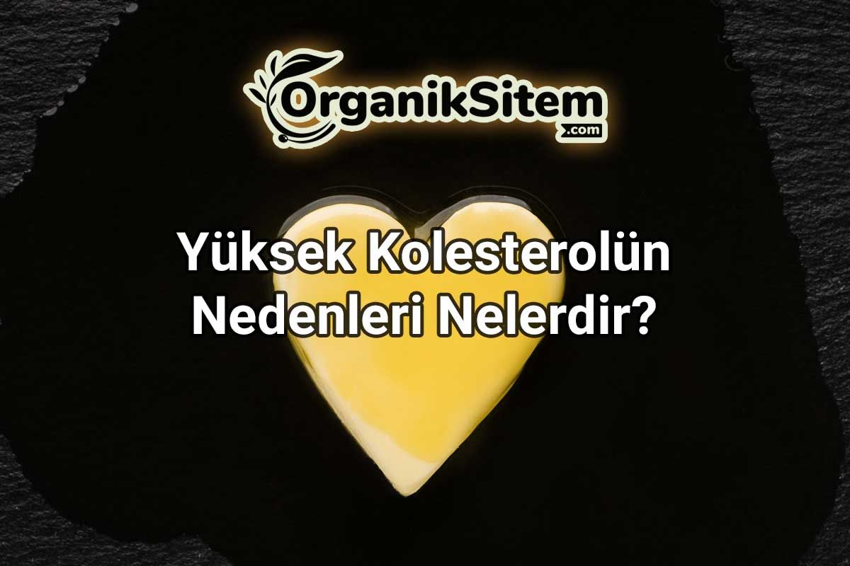 Yüksek Kolesterolün Nedenleri Nelerdir?